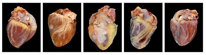 Angela Strassheim, Hearts , 2007 - 2011