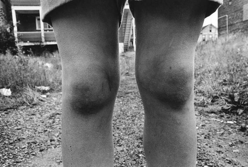  Dark Knees. WIlkes-Barre, December 1974&nbsp;, 	16 x 20 inch gelatin silver print