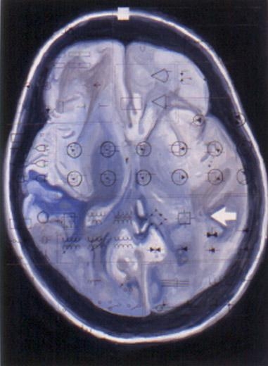 Blue Brain, 2000