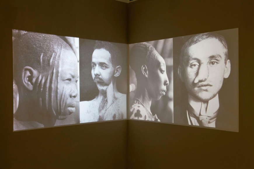 Kader Attia: Contre Nature