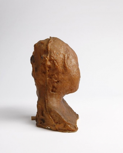 Medardo Rosso, Bambino malato