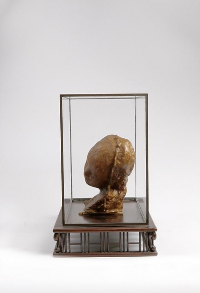 Medardo Rosso, Bambino malato