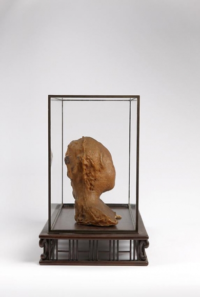 Medardo Rosso, Bambino malato