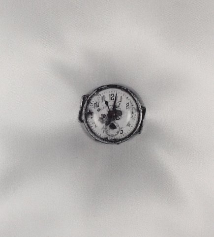 Shomei Tomatsu, "Atomic Bomb Damage",
