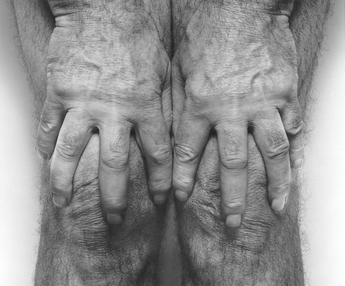 Hands Spread on Knees, 1985, Gelatin silver print mounted to board, printed c. 1990s
