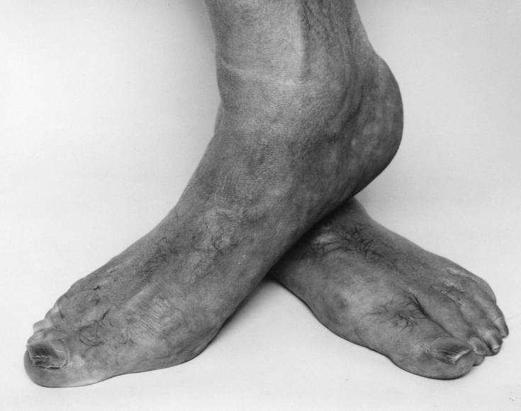 Self Portrait, Feet, Crossed, 1985, Gelatin silver print, printed c. 1985