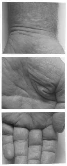 Hand, Three Panels Vertical, 1990, Three gelatin silver prints mounted to board, printed c. 2000