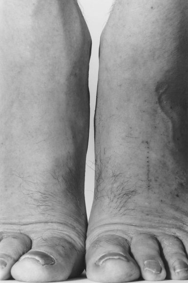 Feet Frontal, 1984, Gelatin silver print mounted to board, printed c. 1999
