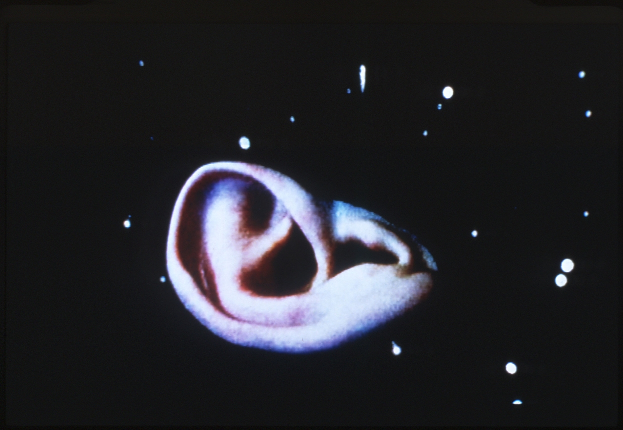 Pipilotti Rist , Extremitäten (weich, weich) (Extremities (smooth, smooth), 1999