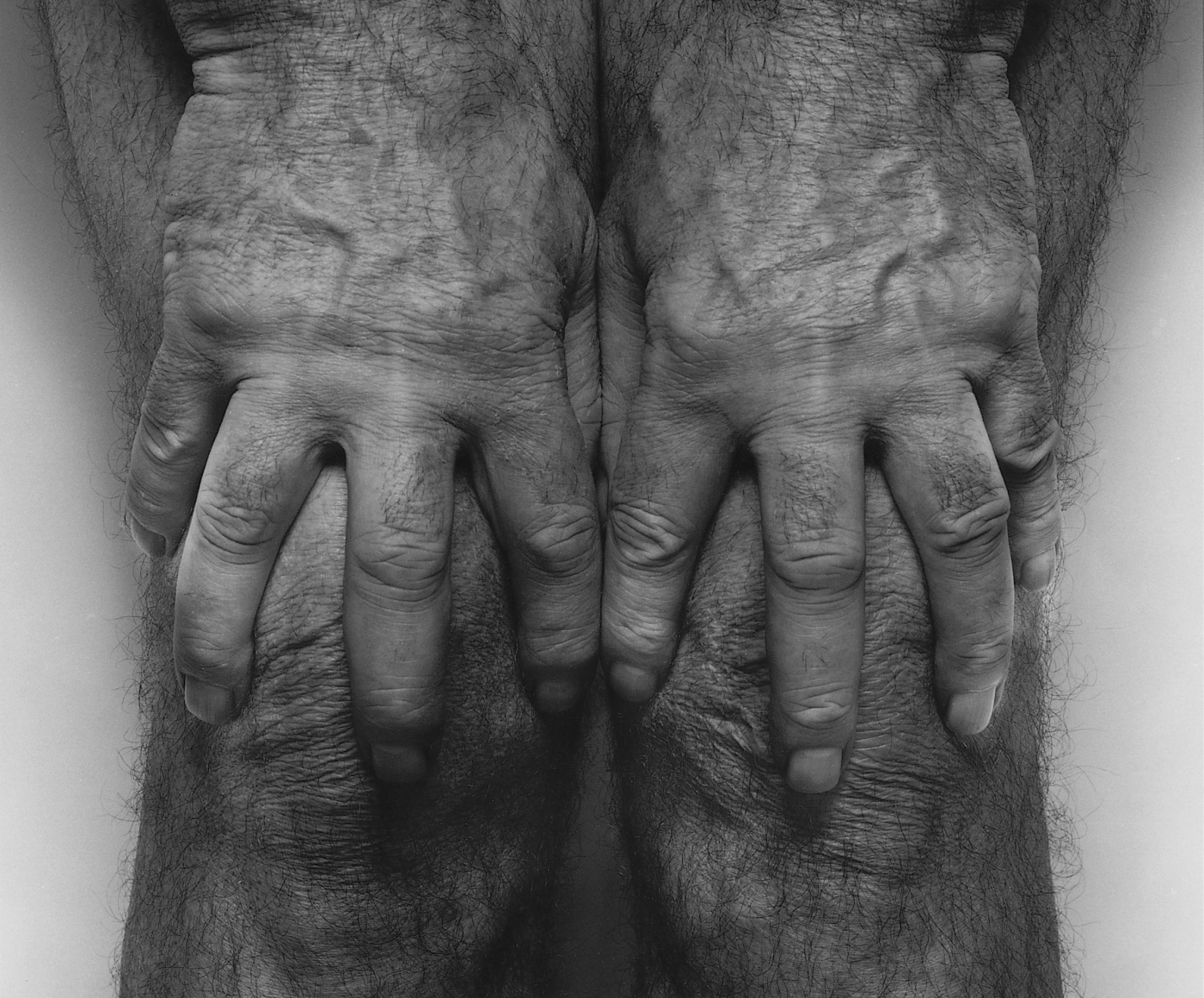 John Coplans, Hands Spread on Knees