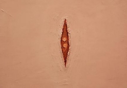 The Visible Vagina