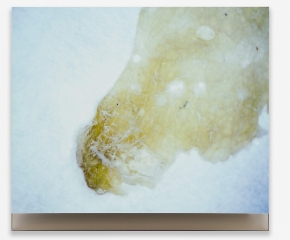 Photo of secreted nasal mucus on pale blue background