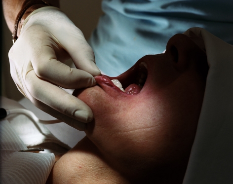 Torbjørn Rødland, Intraoral no. 2, 2015.