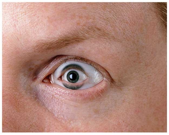 Anne Collier Eye, 2004
