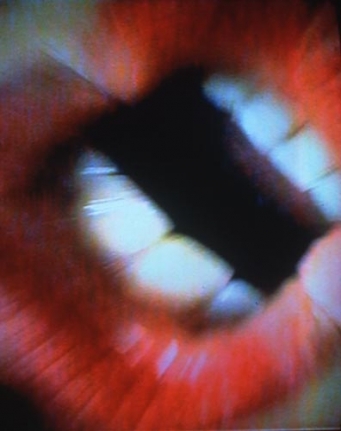 Pipilotti Rist Mutaflor, 1996