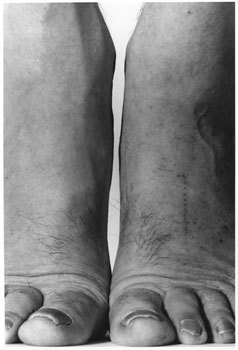 John Coplans Self-Portrait (Feet Frontal) 1984