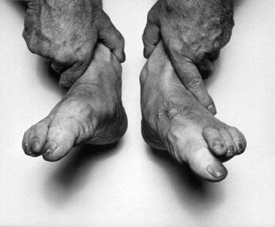 John Coplans Self Portrait (Hands Holding Feet) 1985