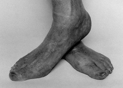 John Coplans Self Portrait (Feet Crossed) 1985