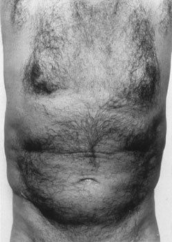 John Coplans Self Portrait (Torso, Front) 1984