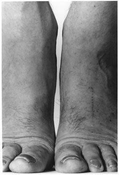 John Coplans Self-Portrait (Feet Frontal) 1984