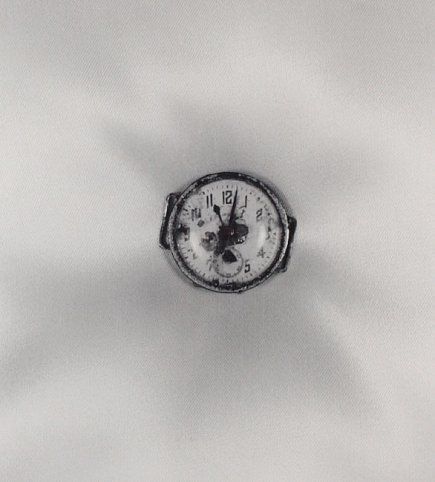 Shomei Tomatsu, "Atomic Bomb Damage",