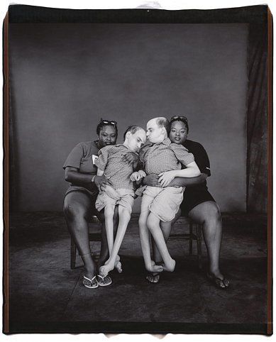 Bruce and Brian Kuzak, with their nurses, Teresa and Tillie Merriweather, 2001, Unique polaroid