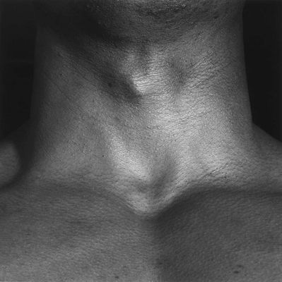 Neck/Livingston, 1988
