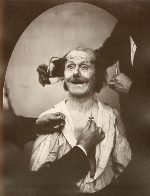 DUCHENNE DE BOULOGNE and Adrien TOURNACHON (French, 1806-1875 & 1825-1903) A false, incomplete expression of agreeable surprise, or admiration, 1862, negative, circa 1856 Albumen print from a glass negative 22.3 x 16.8 cm oval on 22.8 x 17.5 cm paper, mounted on 40.9 x 27.5 cm paper "Fig 33" in pencil on mount verso