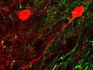 Two neurons glowing red with myelin stained green