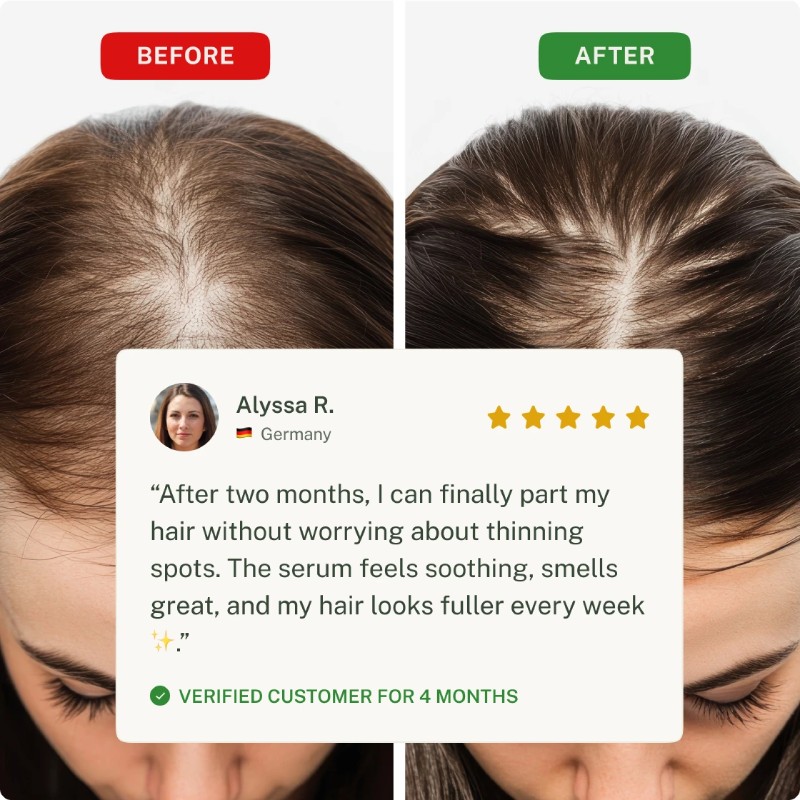 Roota Hair Growth Serum Before and After