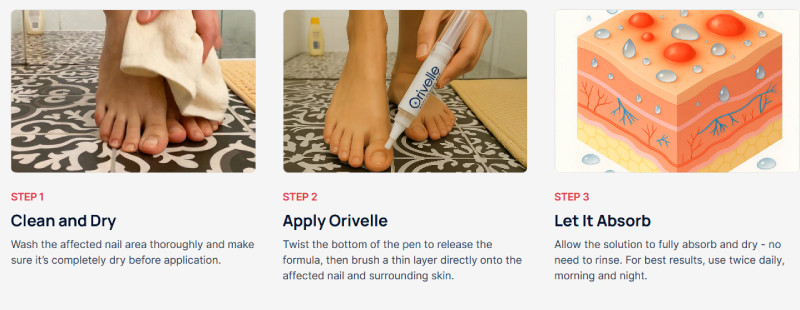 Use Orivelle Anti-Fungal Pen