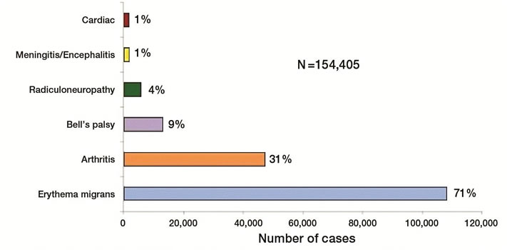 the clinical features and treatment of the lyme disease Among residents of lyme, connecticut where is lyme disease prevalent a prospective study of clinical features for the treatment of lyme disease. the clinical features and treatment of the lyme disease Among residents of lyme, connecticut where is lyme disease prevalent a prospective study of clinical features for the treatment of lyme disease.