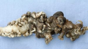 Plant Disease Research Can Learn a Lot from Medicine