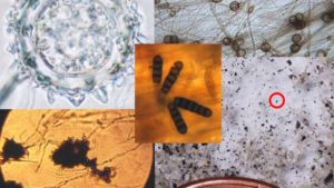 What the Search for Life on Mars and Microbes on Earth Have in Common