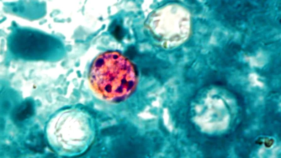 Are Cyclospora Concerns Affecting Consumer Demand for Fresh Produce?