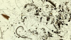 Did you Know? Some Nematodes Offer Natural Defense for Cranberries