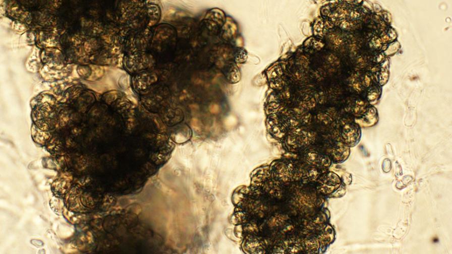 Verticillium Dahliae under the microscope
