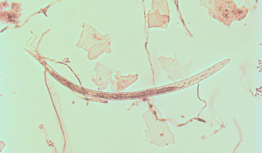 root-knot nematode under a microscope