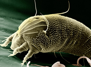 Microscopic Mites