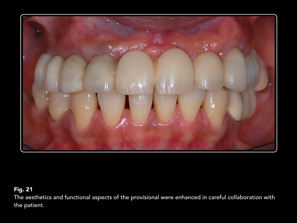 Maxillary swelling differential diagnosis picture