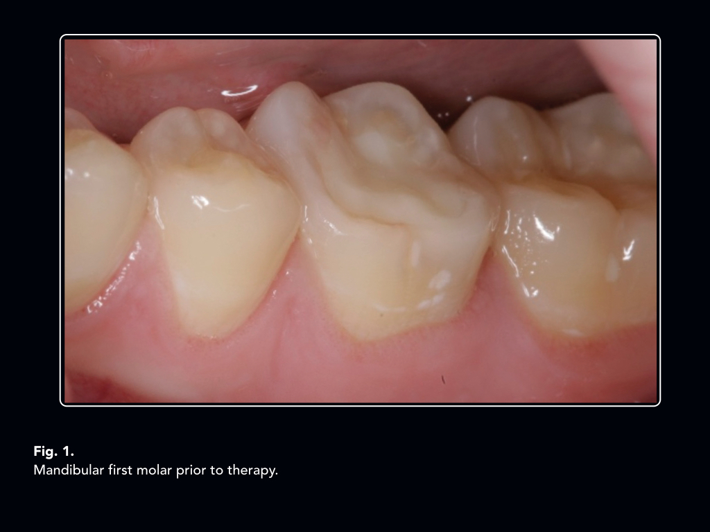 Milwaukee socket set picture