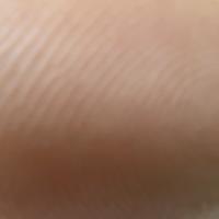 dr avesh mohd freelance gene therapy expert for hire