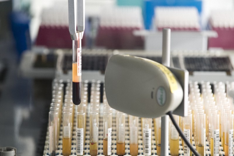 Se analiza una muestra en el Biobanco del Reino Unido. La base de datos vincula datos genéticos a información sobre 2.500 rasgos.