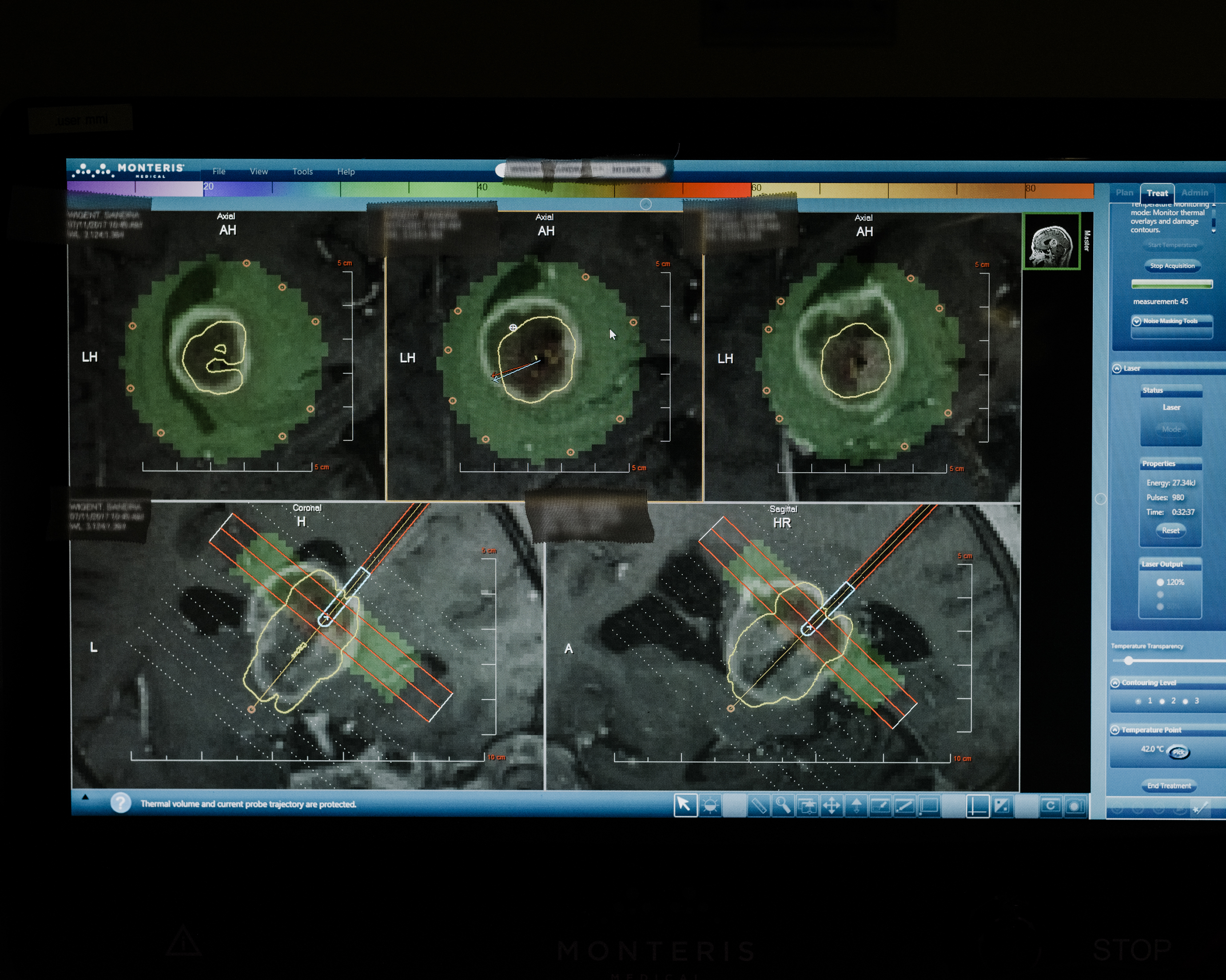 En esta pantalla de la computadora de la sala de control, el láser se monitorea en tiempo real.