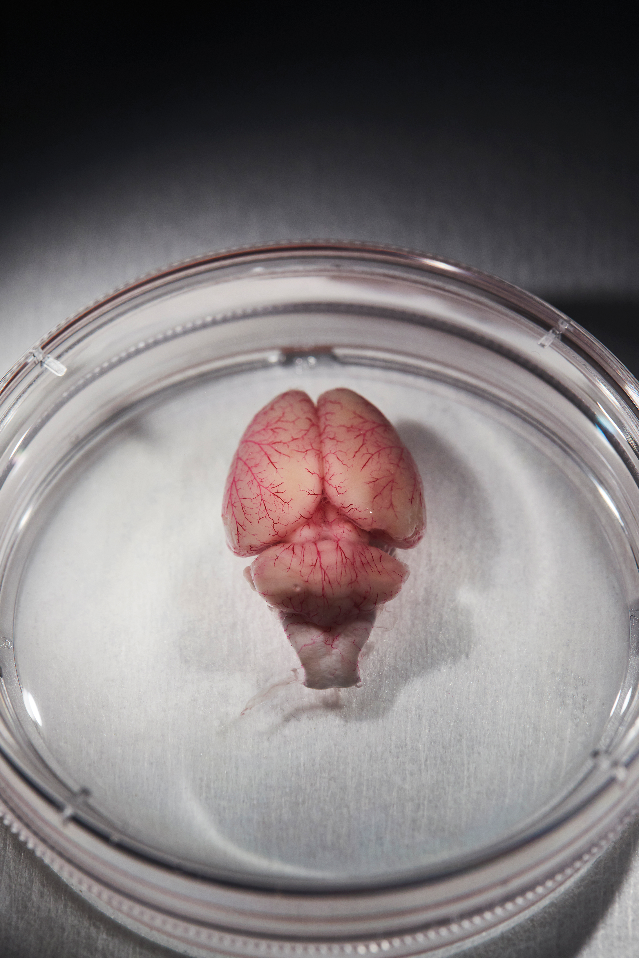 Un cerebro de rata en un plato y una representación de dos neuronas con dendritas espinosas.