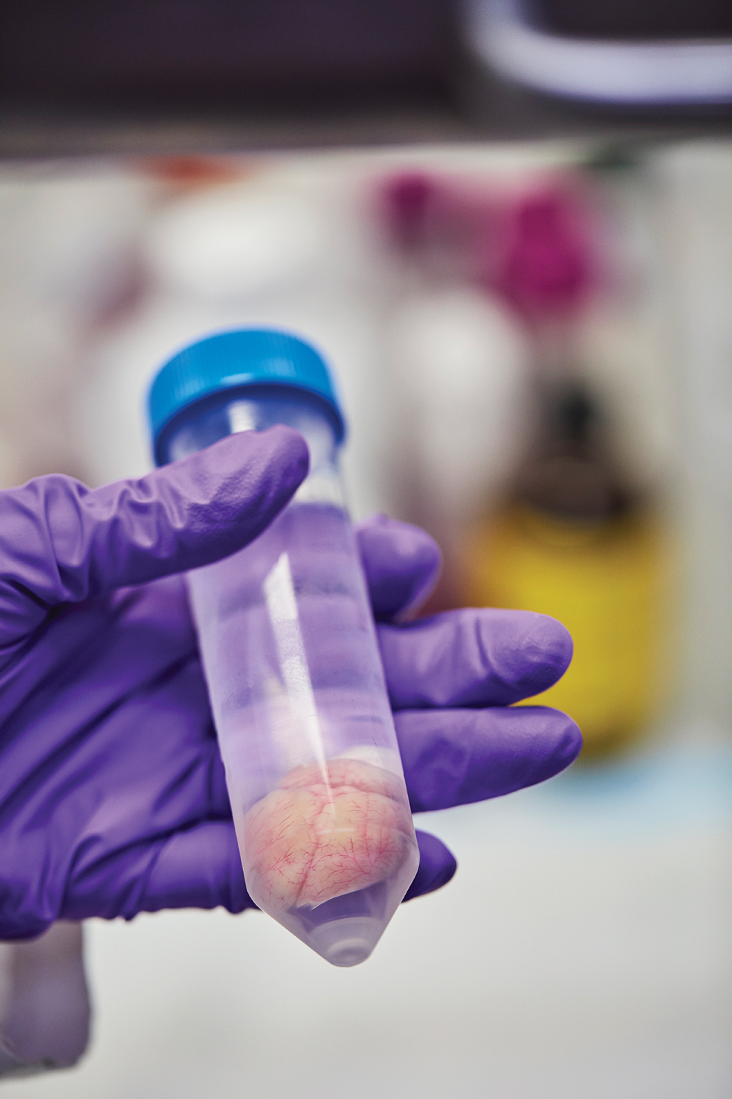 Después de la prueba, el cerebro del animal ha sido removido.