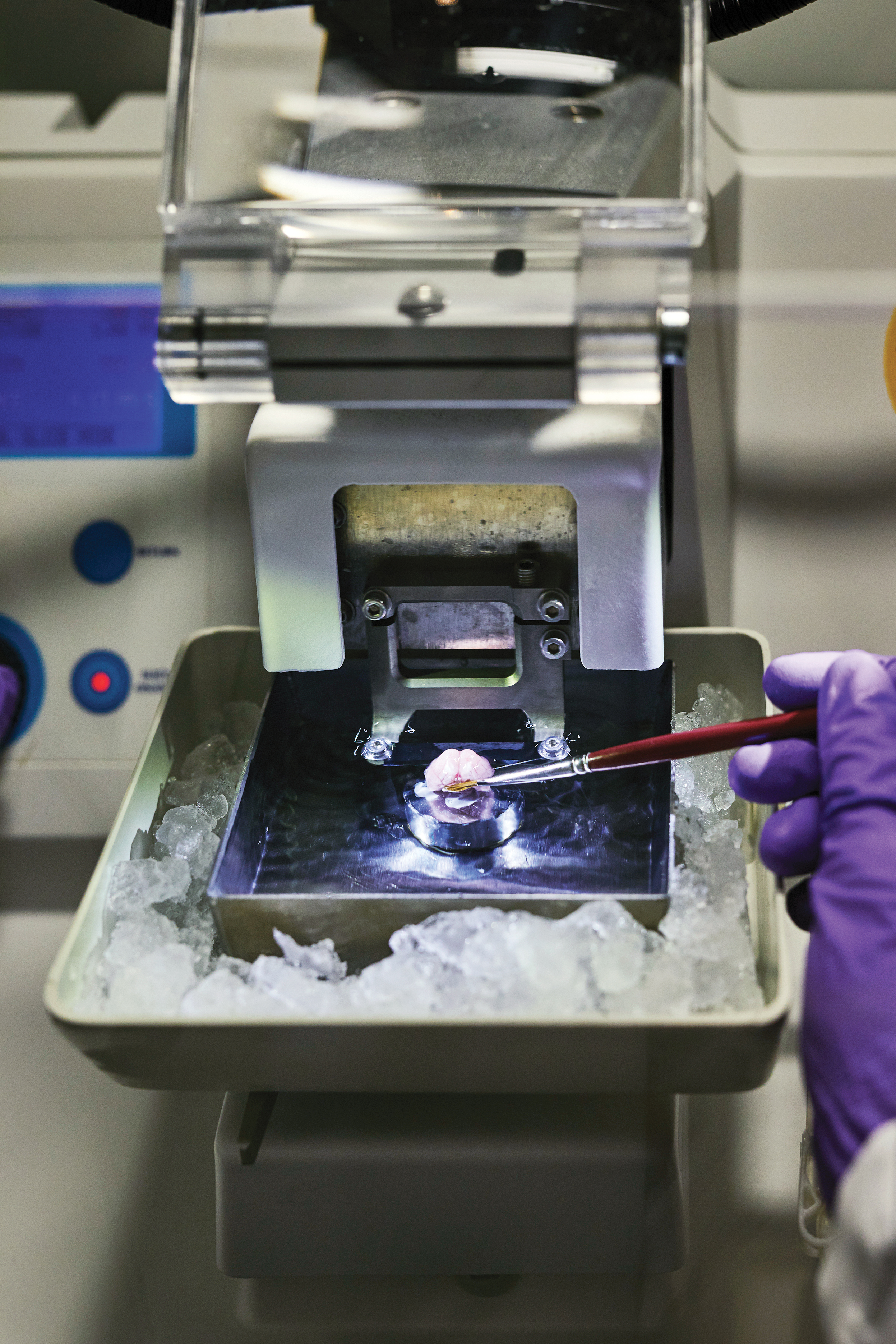 El cerebro se pega a una placa antes de ser escaneado.