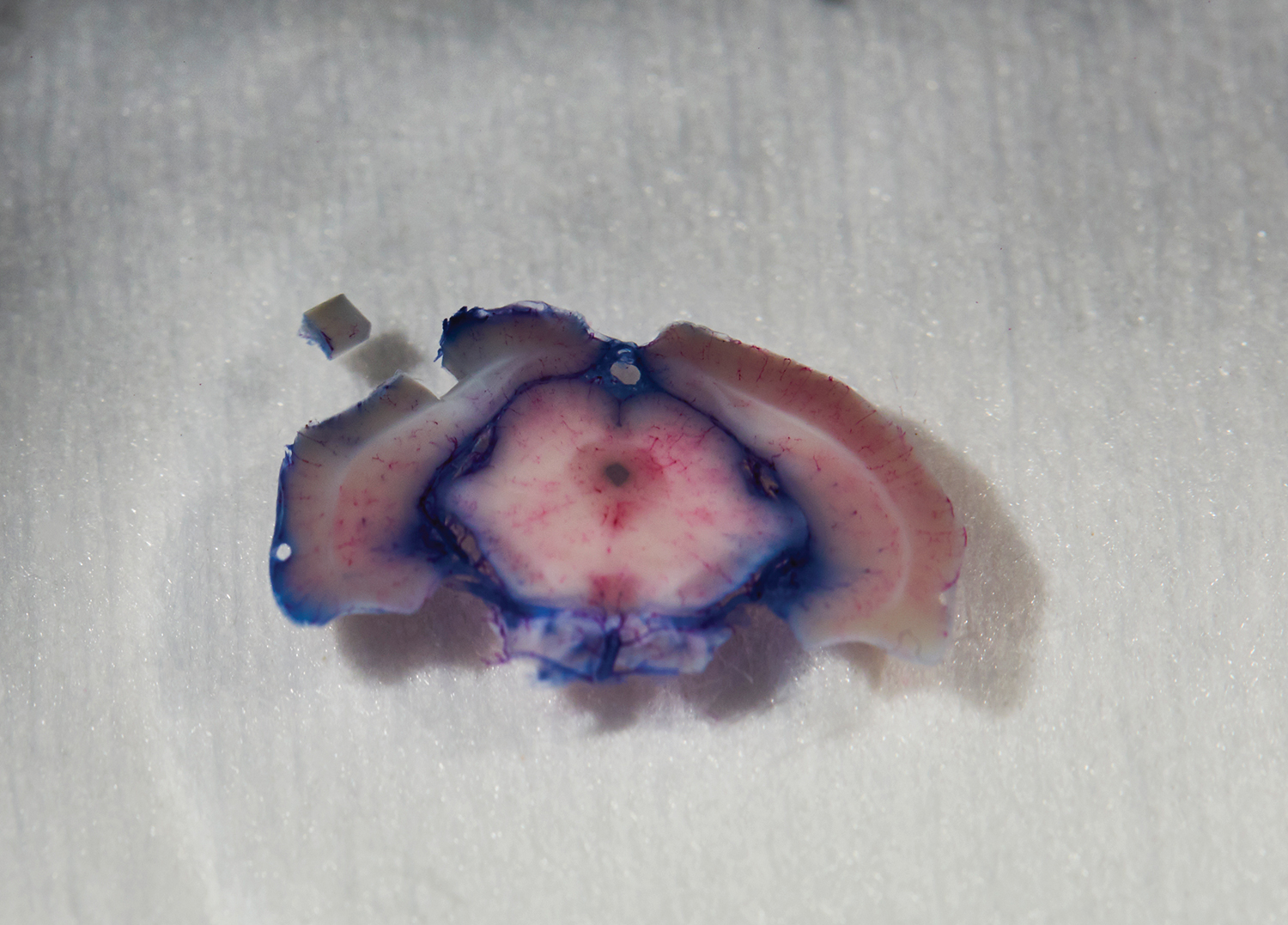 <strong> Izquierda: </ strong> El pequeño cubo en la parte superior izquierda es la parte del cerebro que será mapeada. <strong> Derecha: </ strong> ese pedazo del cerebro está encerrado en acrílico en la preparación para ser cortado extremadamente fino.