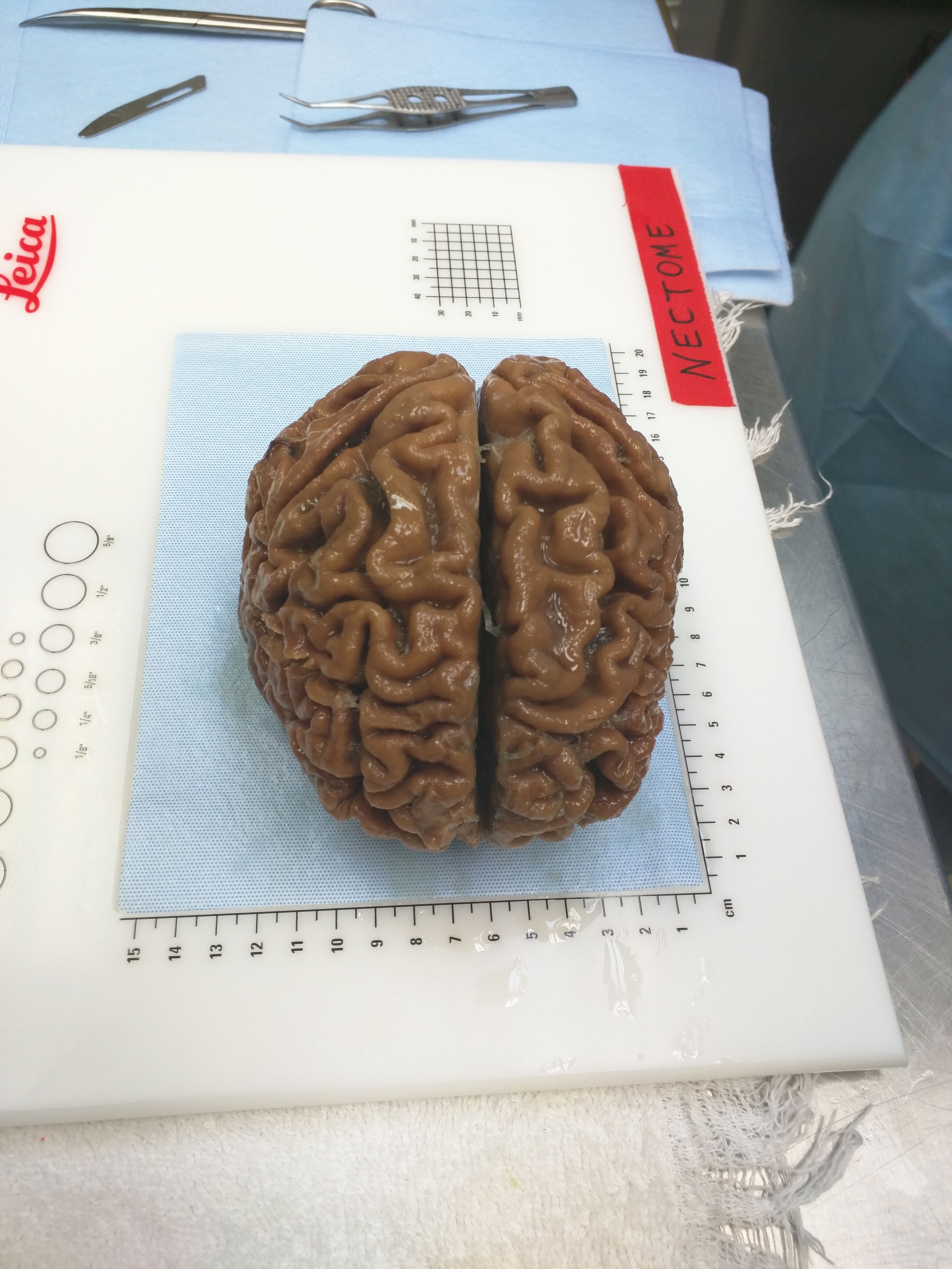 Despite Dearth Of Data Firms Sell Brain >> A Startup Is Pitching A Mind Uploading Service That Is 100 Percent Despite Dearth Of Data Firms Sell Brain >> A Startup Is Pitching A Mind Uploading Service That Is 100 Percent