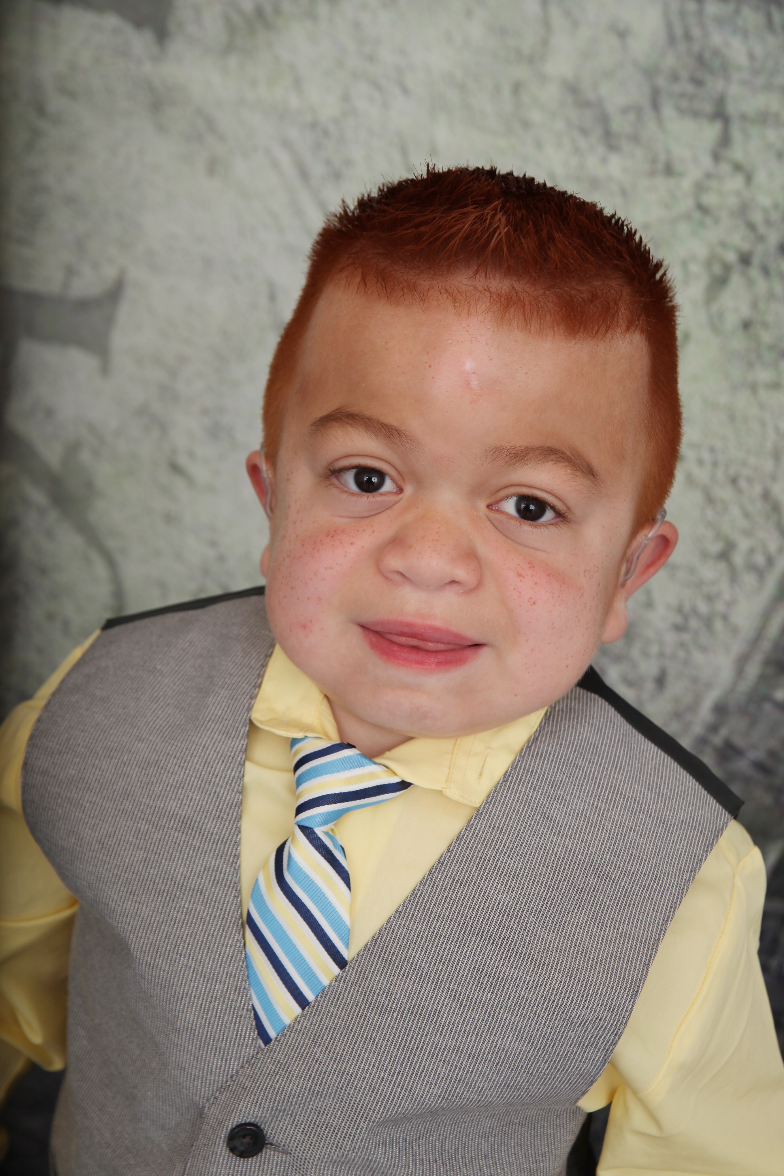 Dominic Henriquez, de 7 años, tiene el síndrome de Hunter, una rara enfermedad que afecta a muchas partes diferentes del cuerpo.